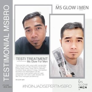 Jual Ms Glow For Men Asli Manfaat Harga Cara Pakai