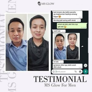 Jual Ms Glow For Men Asli Manfaat Harga Cara Pakai